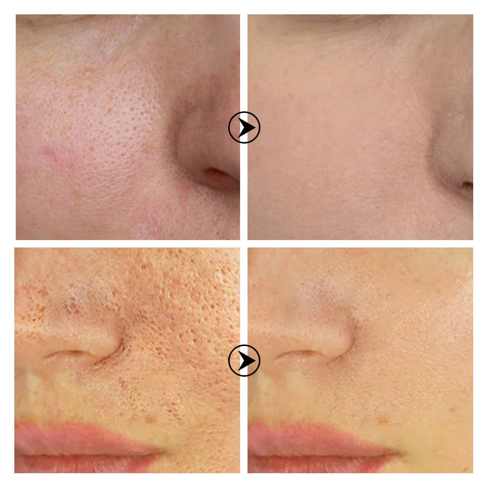 Tea tree pore shrinking serum - Image 2