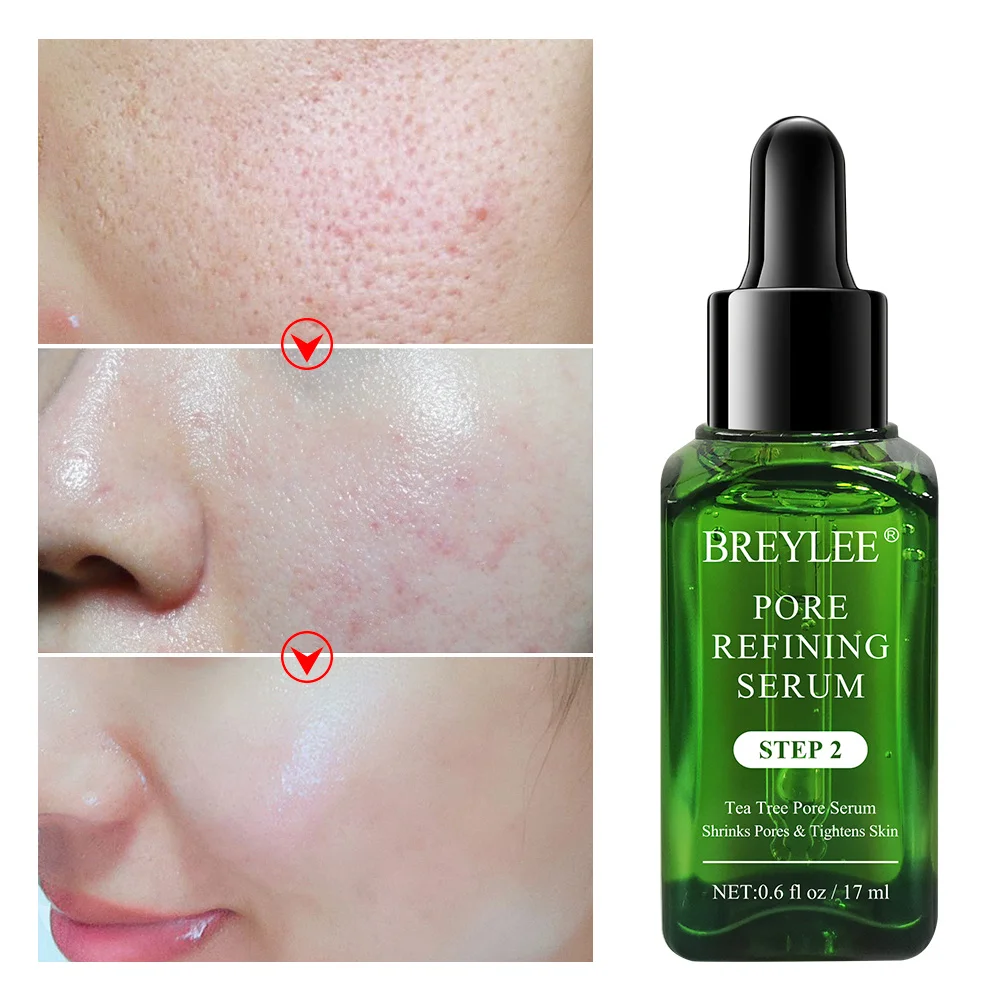 Tea tree pore shrinking serum - Image 3