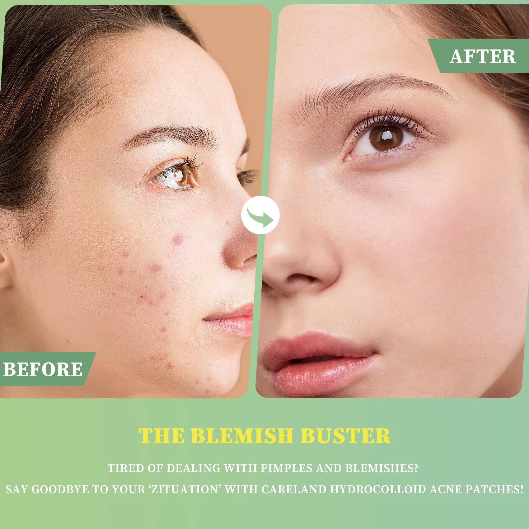 Essential Oil Acne Patch